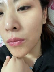 体验前-大连美天医疗美容医院