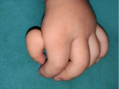 -华中科技大学同济医学院附属协和医院(主院区)