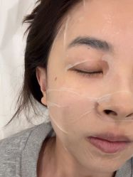 体验后-海涛医疗美容·面部抗衰·注射美鼻