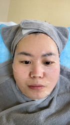 体验后-北京爱育华医院-医疗美容科
