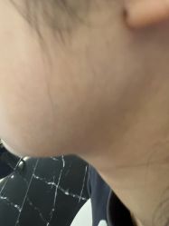 -美瑞莎创美医疗美容