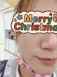 体验前-上海玫瑰医疗美容医院