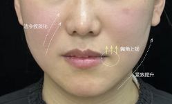 点击看大图 -Yestar 嘉兴艺星医疗美容医院