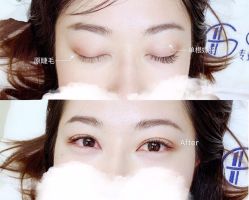 -MOE BEAUTY.皮肤管理中心