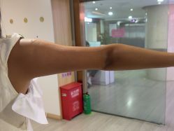 -安徽合肥韩美整形外科医院