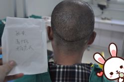 点击看大图 -大麦微针植发丨全国连锁