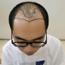 -雍禾植发全国连锁