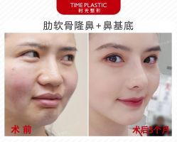 -上海时光整形外科医院