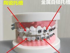 -团圆口腔·种植中心(锦江院区)
