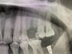 -牙博士口腔品牌连锁(杨浦店)