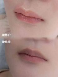 -西施无菌半永久纹绣眉眼影唇轻增发纹发际线