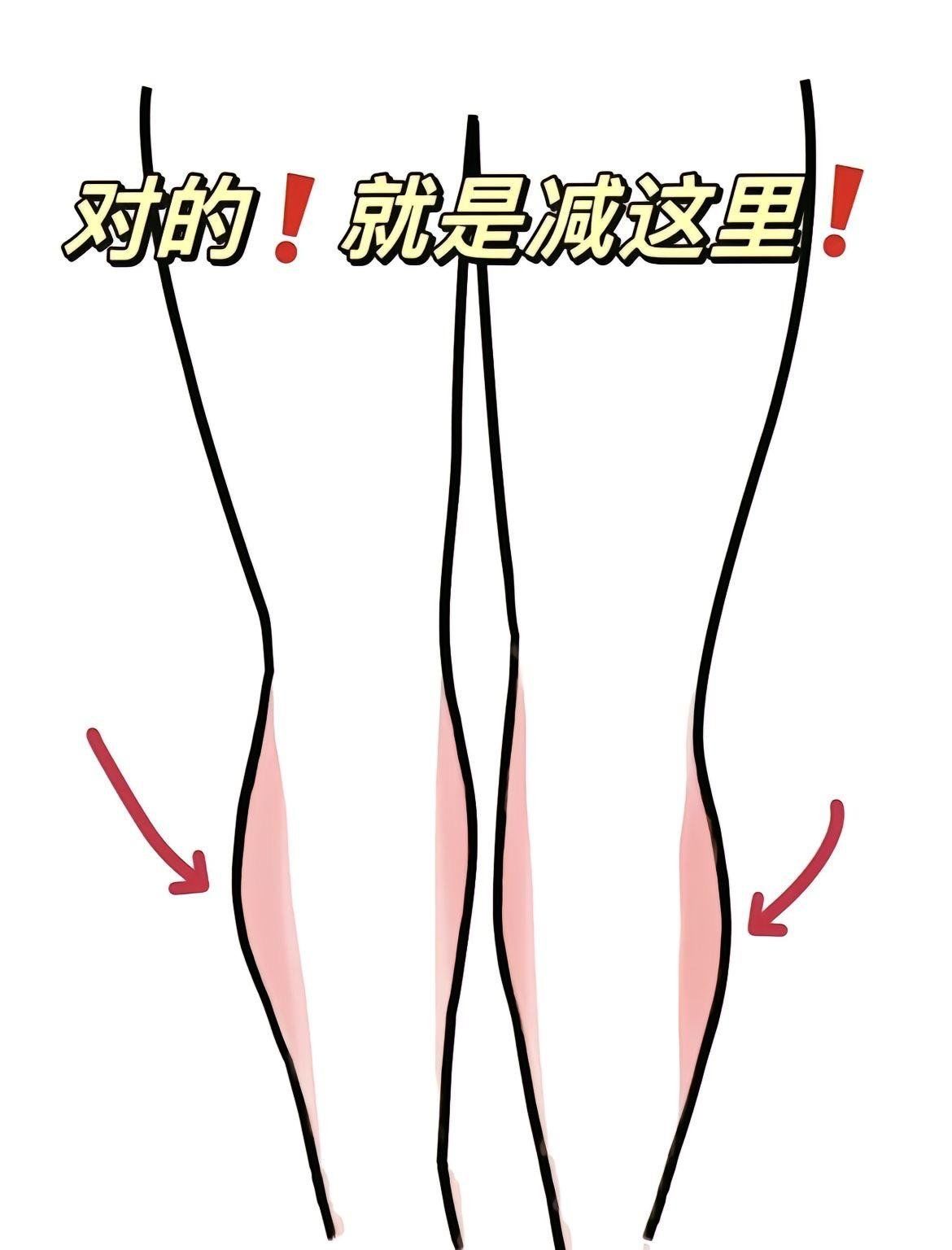 瘦小腿 小腿粗壮,水肿 脂包肌姐妹码住