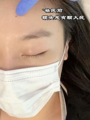 -清疣美疣·痣·斑净肤中心