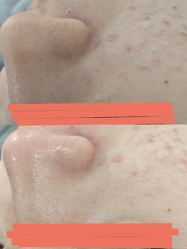-SKIN79皮肤管理中心