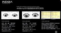 -半岛故事·法儿曼抗衰·indiba中心