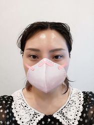 体验后-More摩尔医美の注射线雕光电中心