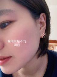 体验前-纯粹医美