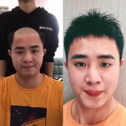 -发饰美男士增发补发假发定制店