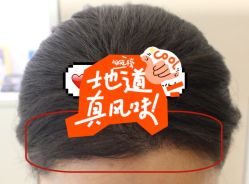 -大麦微针植发全国连锁