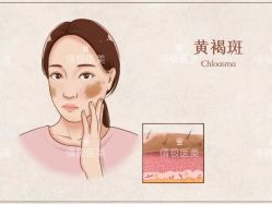 -倩极·精研痘敏肌管理
