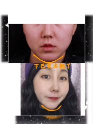 -美莱医学美容医院