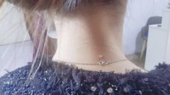 -痣清宫祛斑祛痣连锁店