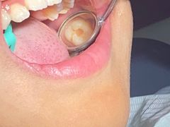 -安柏口腔(海珠世纪云顶店)