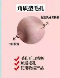 -凡碧诗毛孔清洁收细