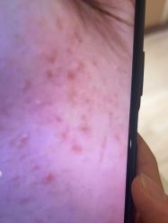 -苑苑vbeauty科技美容SPA
