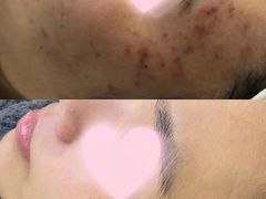 -上置·美兰优湖