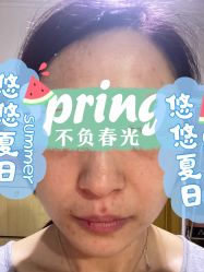 体验后-圣嘉新医疗美容医院