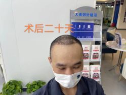点击看大图 -大麦微针植发全国连锁