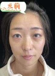 -素美医疗美容·西南眼鼻整形·修复基地
