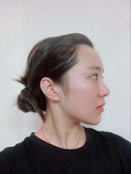 -小忠丽格医美