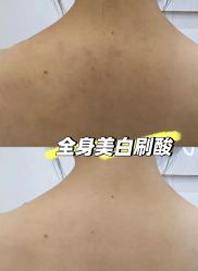-春田皮肤管理中心品牌旗舰店