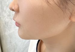 -长沙雅美医疗美容医院