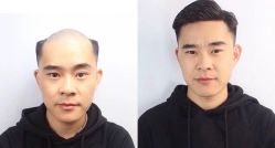 -发饰美男士增发补发假发定制店