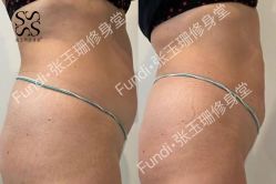 -Fundi张玉珊修身堂·indiba·BTL科技瘦身