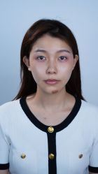 -佛山曙光金子医学美容医院