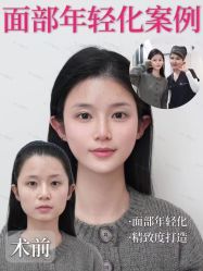 -Yestar宁波艺星整形医院