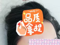 -大麦微针植发全国连锁