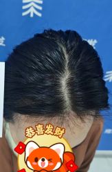 点击看大图 -雍禾植发