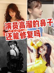 点击看大图 -小忠丽格医美