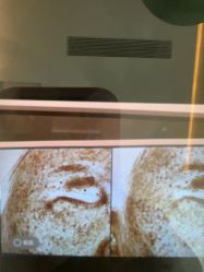 点击看大图 -苑苑vbeauty科技美容SPA
