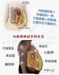 -香薇妮丝女子减肥院