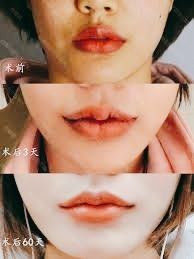 -SKINIST丽铂医疗美容