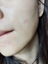 点击看大图 体验前-大连美天医疗美容医院