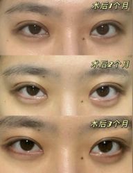 -上海漾颜医疗美容