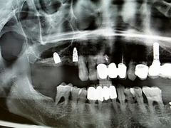 -佛山中大口腔医院·市二级口腔专科医院