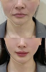 -Dr.U博士医疗美容医院